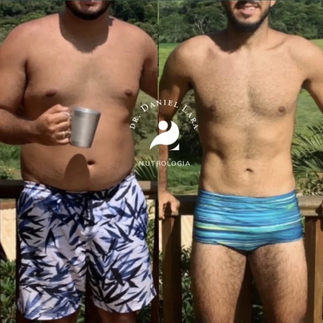 Resultados reais de paciente — emagrecimento com acompanhamento nutrológico
