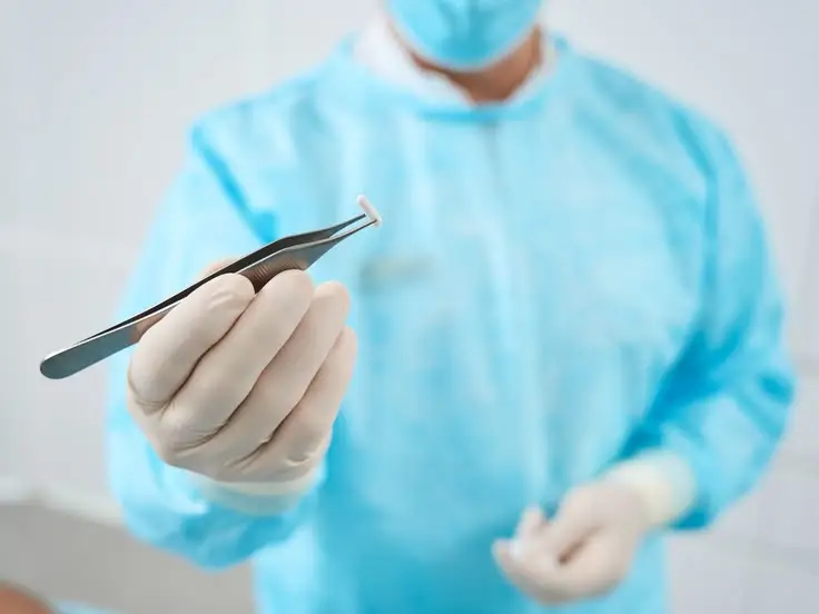 IMPLANTES HORMONAIS